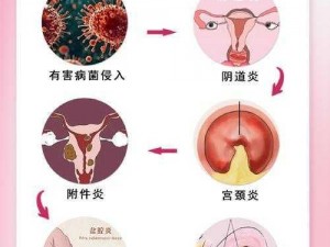 法国妇科急诊室1984_法国妇科急诊室 1984：揭示医疗体系的挑战与变革